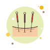 Acupuncture